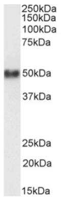 Western Blot: CD38 Antibody (AT13/5)ChimericAzide and BSA Free [NBP2-81055]