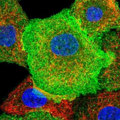 Immunocytochemistry/ Immunofluorescence: CD38 Antibody [NBP1-86010]