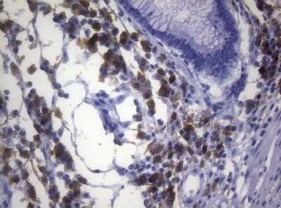 Immunohistochemistry: CD38 Antibody (OTI1C9) - Azide and BSA Free [NBP2-70376]