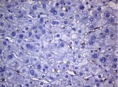 Immunohistochemistry: CD38 Antibody (OTI1C9) - Azide and BSA Free [NBP2-70376]
