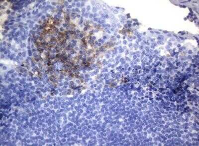 Immunohistochemistry: CD38 Antibody (OTI1C9) - Azide and BSA Free [NBP2-70376]