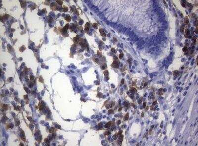 Immunohistochemistry-Paraffin: CD38 Antibody (OTI1C9) [NBP2-46145]