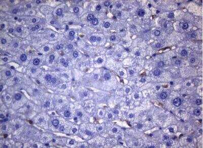 Immunohistochemistry-Paraffin: CD38 Antibody (OTI1C9) [NBP2-46145]