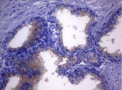 Immunohistochemistry-Paraffin: CD38 Antibody (OTI1C9) [NBP2-46145]