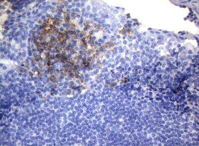 Immunohistochemistry-Paraffin: CD38 Antibody (OTI1C9) [NBP2-46145]