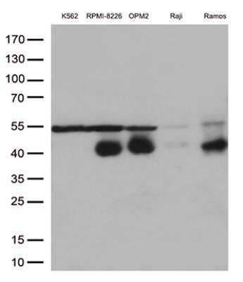 Western Blot: CD38 Antibody (OTI1C9) [NBP2-46145]