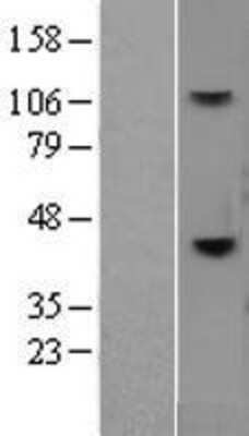 Western Blot: CD38 Overexpression Lysate [NBL1-08942]