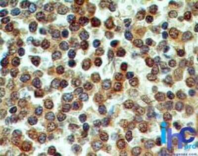 Immunohistochemistry-Paraffin: CD39/ENTPD1 Antibody (17B5F11) - Azide Free [NBP2-25226]