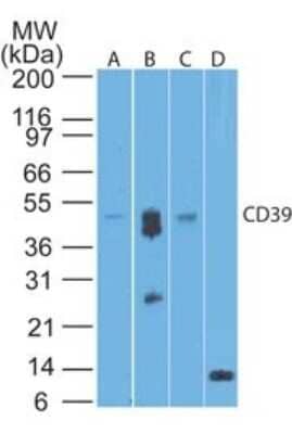 Western Blot: CD39/ENTPD1 Antibody (17B5F11)Azide Free [NBP2-25226]