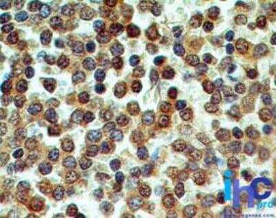 Immunohistochemistry-Paraffin: CD39/ENTPD1 Antibody (17B5F11) - BSA Free [NBP2-25223]