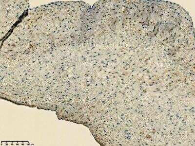Immunohistochemistry-Paraffin: CD39/ENTPD1 Antibody [NBP1-90071]