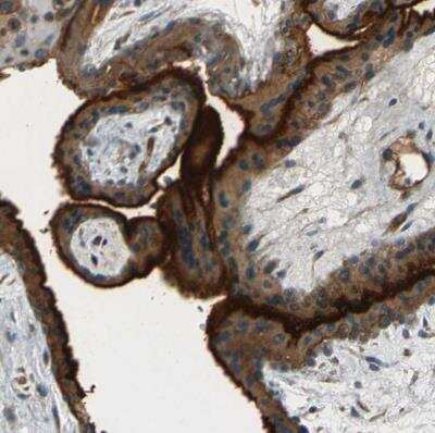 Immunohistochemistry-Paraffin: CD39/ENTPD1 Antibody [NBP1-90071]