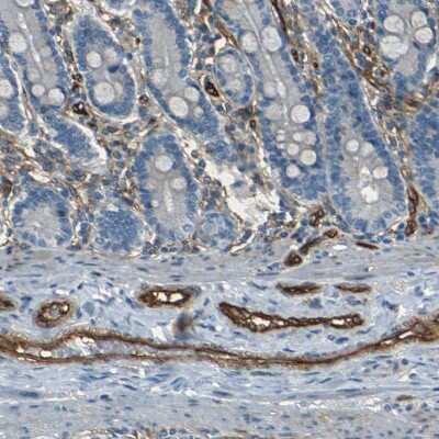 Immunohistochemistry-Paraffin: CD39/ENTPD1 Antibody [NBP1-90071]