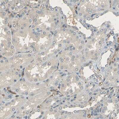Immunohistochemistry-Paraffin: CD39/ENTPD1 Antibody [NBP1-90071]