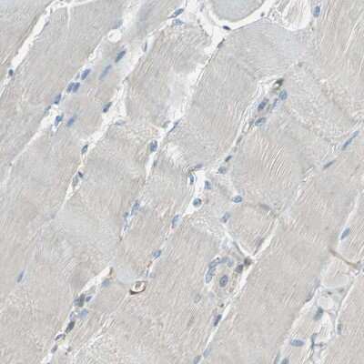 Immunohistochemistry-Paraffin: CD39/ENTPD1 Antibody [NBP1-90071]