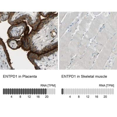 Immunohistochemistry-Paraffin: CD39/ENTPD1 Antibody [NBP1-90071]