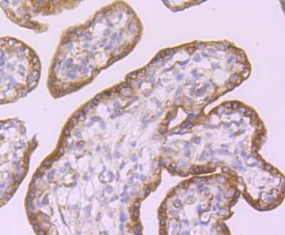 Immunohistochemistry-Paraffin: CD39/ENTPD1 Antibody (JA90-36) [NBP2-67230]