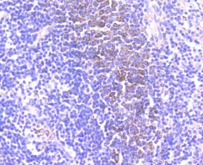 Immunohistochemistry-Paraffin: CD39/ENTPD1 Antibody (JA90-36) [NBP2-67230]