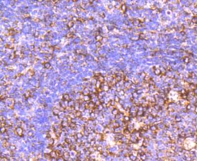 Immunohistochemistry-Paraffin: CD39/ENTPD1 Antibody (JA90-36) [NBP2-67230]