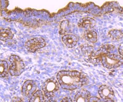 Immunohistochemistry-Paraffin: CD39/ENTPD1 Antibody (JA90-36) [NBP2-67230]