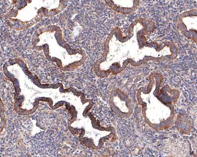 Immunohistochemistry-Paraffin: CD39/ENTPD1 Antibody (JA90-36) [NBP2-67230]