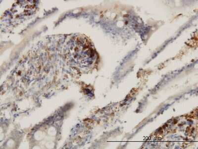 Immunohistochemistry-Paraffin: CD39L2/ENTPD6 Antibody (2D10) [H00000955-M03]