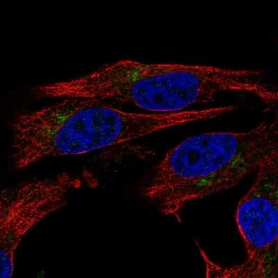 Immunocytochemistry/ Immunofluorescence: CD39L2/ENTPD6 Antibody [NBP2-58760]