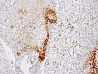 Immunohistochemistry-Paraffin: CD39L2/ENTPD6 Antibody [NBP1-32294]