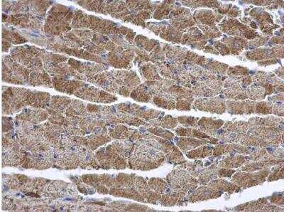 Immunohistochemistry-Paraffin: CD39L2/ENTPD6 Antibody [NBP1-32294]