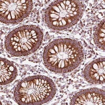 Immunohistochemistry-Paraffin: CD39L2/ENTPD6 Antibody [NBP2-57315]