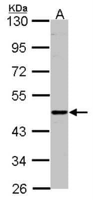 CD39L2/ENTPD6 Antibody (NBP1-32294) | Bio-Techne