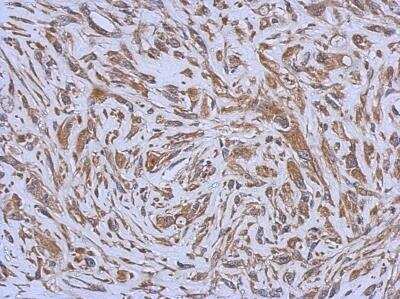 Immunohistochemistry-Paraffin: CD39L3/ENTPD3 Antibody [NBP1-32471]