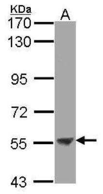 Western Blot: CD39L3/ENTPD3 Antibody [NBP1-32471]