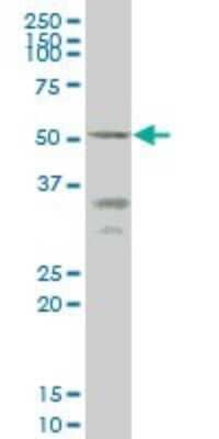 Western Blot: CD39L4/ENTPD5 Antibody (4A5) [H00000957-M07]