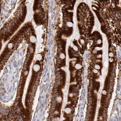 Immunohistochemistry-Paraffin: CD39L4/ENTPD5 Antibody [NBP1-85751]
