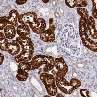 Immunohistochemistry-Paraffin: CD39L4/ENTPD5 Antibody [NBP1-85751]