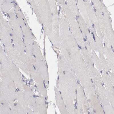 Immunohistochemistry-Paraffin: CD39L4/ENTPD5 Antibody [NBP1-85751]