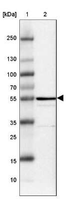 Western Blot: CD39L4/ENTPD5 Antibody [NBP1-85751]