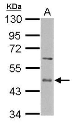 Western Blot: CD39L4/ENTPD5 Antibody [NBP2-16342]