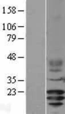 Western Blot: CD3 gamma Overexpression Lysate [NBL1-08946]