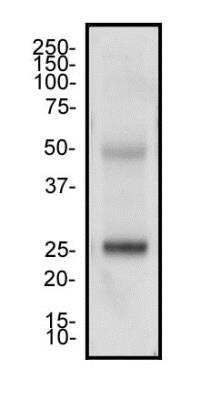 Western Blot: CD4 Antibody (B486A1)BSA Free [NB100-2181]