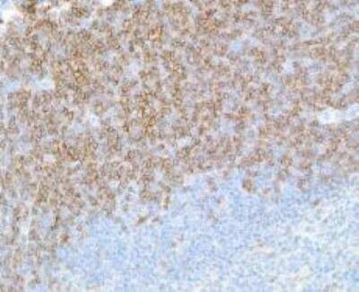 Immunohistochemistry-Paraffin: CD4 Antibody (BLR167J) [NBP3-14741]