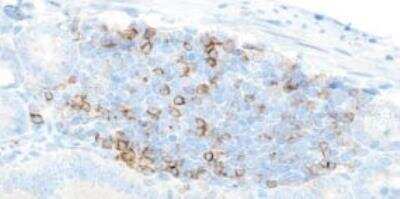 Immunohistochemistry-Paraffin: CD4 Antibody (BLR167J) [NBP3-14741]