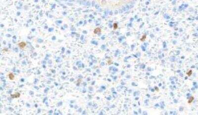 Immunohistochemistry-Paraffin: CD4 Antibody (BLR167J) [NBP3-14741]