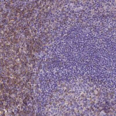 Immunohistochemistry-Paraffin: CD4 Antibody (CL0395) [NBP2-52928]