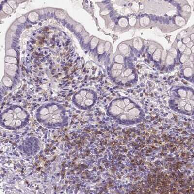 Immunohistochemistry-Paraffin: CD4 Antibody (CL0395) [NBP2-52928]
