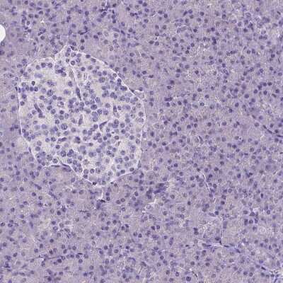Immunohistochemistry-Paraffin: CD4 Antibody (CL0395) [NBP2-52928]