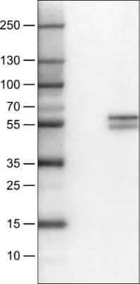 Western Blot: CD4 Antibody (CL0395) [NBP2-52928]