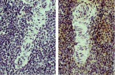 Immunohistochemistry-Paraffin: CD4 Antibody (CT-4) - Azide and BSA Free [NBP1-28266]