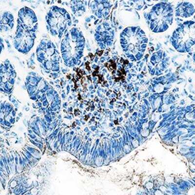 Immunohistochemistry-Frozen: CD4 Antibody (GK1.5) - Azide and BSA Free [NBP2-26585]